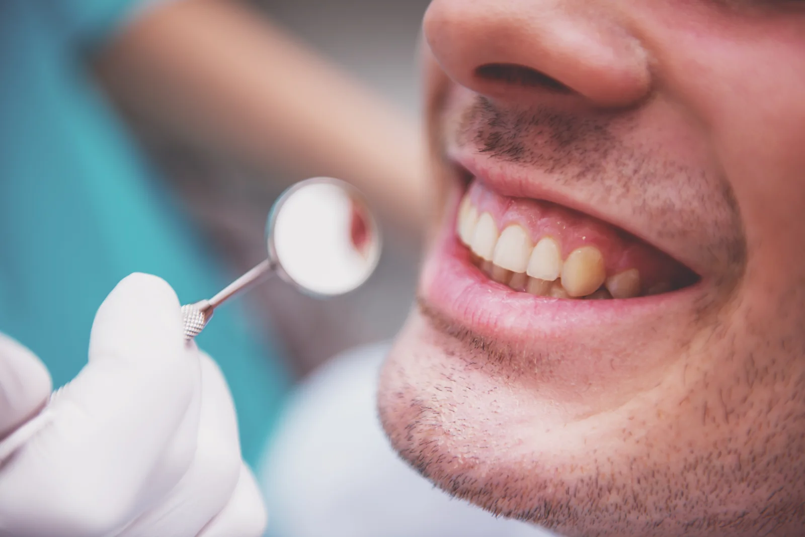Verificarea coroanelor dentare din zirconiu la MC Dental Implant Odobești